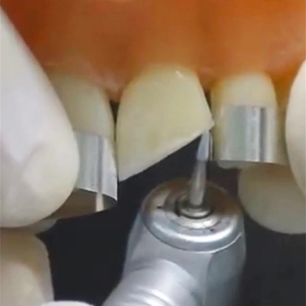 Dental Stainless Steel Matrix Strips Resin Film Restoration Light Cured Resin Clear Matrix Bands Polishing Strip Dental Mater