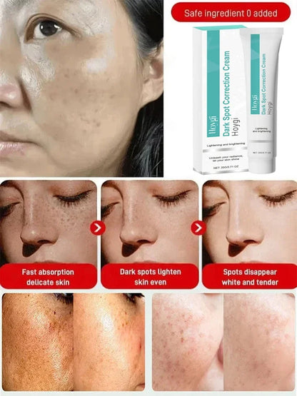 Powerful Spot-removing Whiten Cream Brighten Skin Fast Eliminates Melanin Pigmentation Melasma Dark Spots Moisturize Beauty G