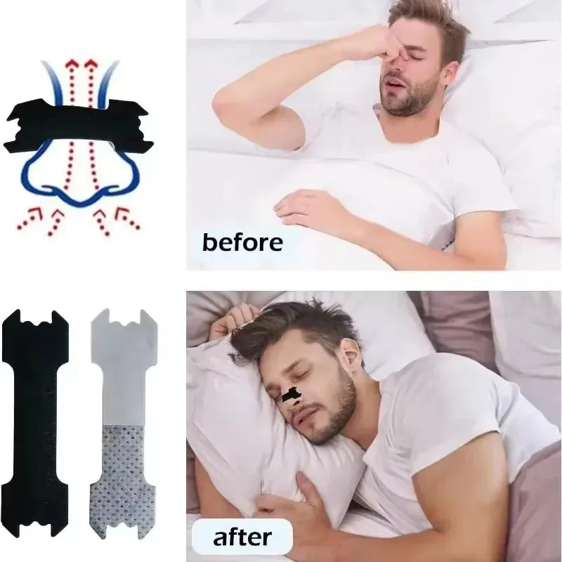 Anti Snoring Nose Patch Set Extra Strength Nasal Strips Better Breathing Non-Invasive Easier Breath Sleep Aid Decive