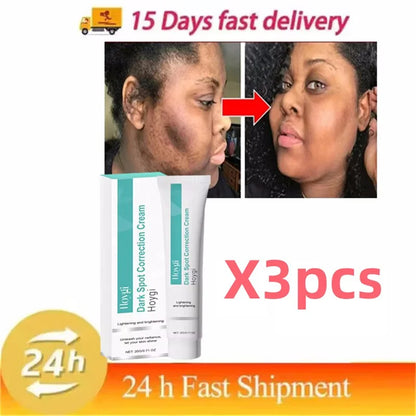 Powerful Spot-removing Whiten Cream Brighten Skin Fast Eliminates Melanin Pigmentation Melasma Dark Spots Moisturize Beauty G
