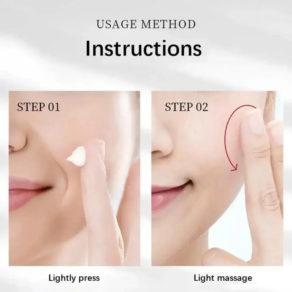 Whitening Freckles Face Cream Removal Melasma Dark Spots Corrector Lighten Melanin Pigmentation Brighten Anti-Aging Beauty Ca