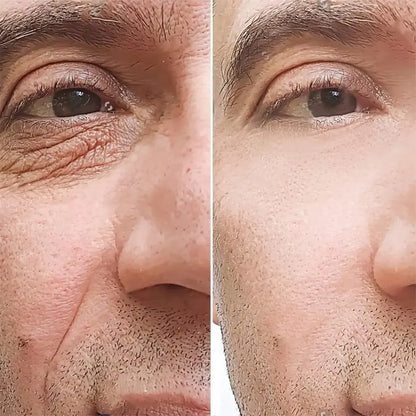 Retinol Anti-wrinkle Cream For Men Collagen Anti-Aging Removal Face Neck Wrinkle Efficient Moisturizing Firming Korean Skin C