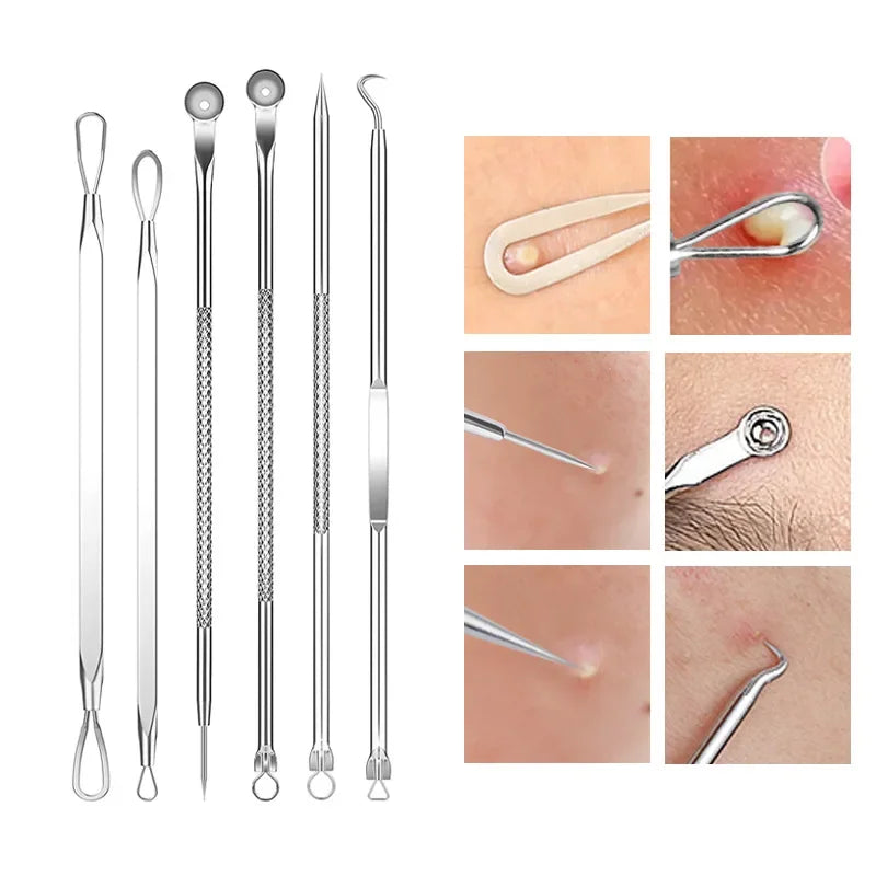 4-11Pcs Ingrown Hair Tweezers Acne Blackhead Removal Needles Black Dots Cleaner Deep Cleansing Pore Cleaner Face Skin Care To