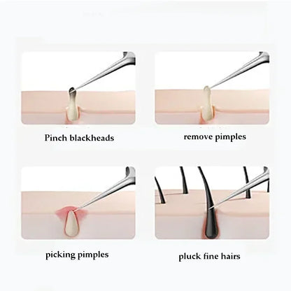 4-11Pcs Ingrown Hair Tweezers Acne Blackhead Removal Needles Black Dots Cleaner Deep Cleansing Pore Cleaner Face Skin Care To