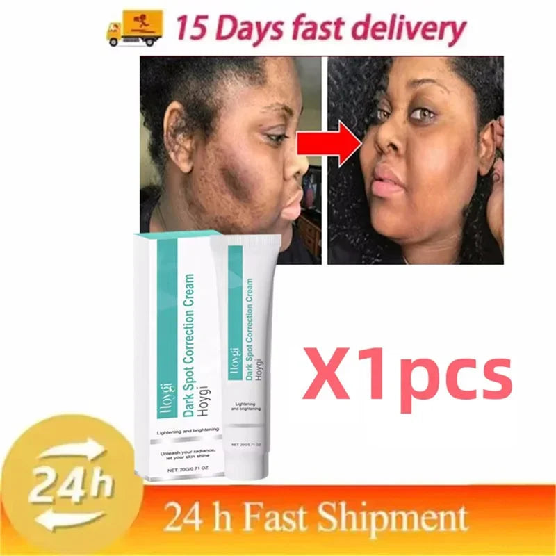 Powerful Spot-removing Whiten Cream Brighten Skin Fast Eliminates Melanin Pigmentation Melasma Dark Spots Moisturize Beauty G